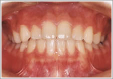 iv̖Goώ@āAiv񊮐҂AсAݍmF  I